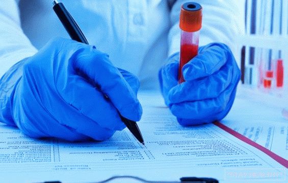 Testul de sânge nou dezvăluie virusul Ebola în 20 de ani minute?