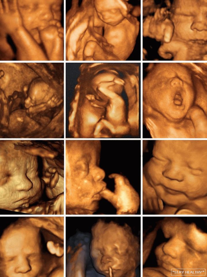 3d фото плода