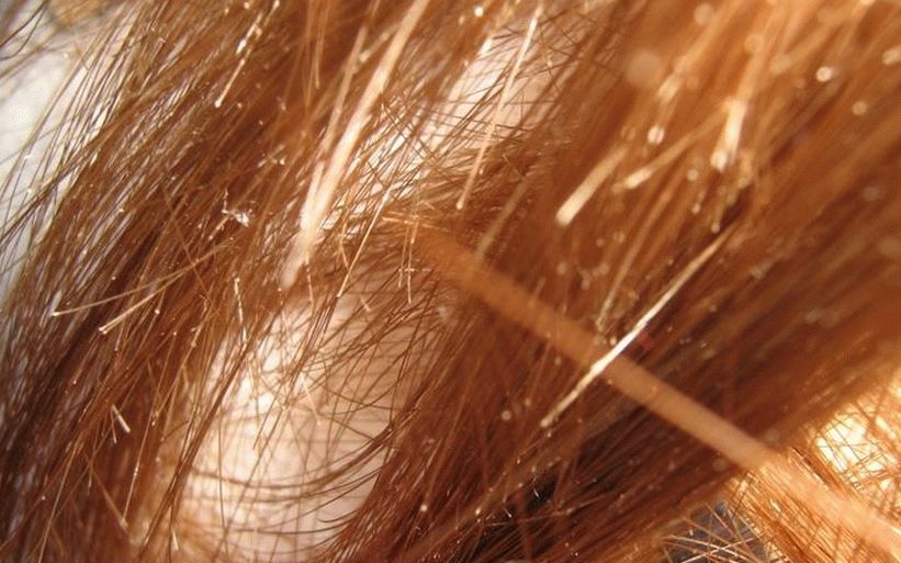 remedii pentru capetele despicate ale părului