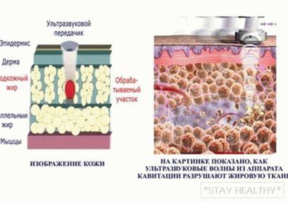 printsip-deystviya-kavitatsii